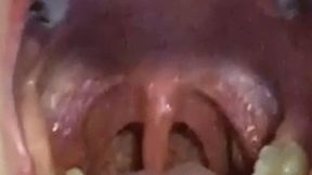 3 CLIPS OF OPEN MOUTH YAWNING