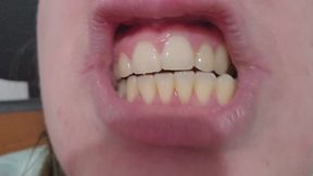 Close-Up of Chubby Girl Clicking Her Teeth With No Food – Intimate Mouth Sounds, Oral Fixation and Fetish for Empty Biting