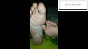 Caribean_feet11 Scaly Itchy Soles for you