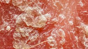 Rashgasm Ritual Day1 BN