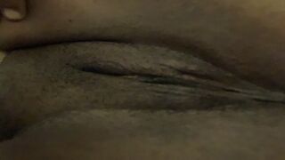 Bald HUGE CLITORIS vagina