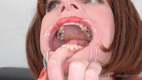 Inside My Mouth - Barbie - Mouth retractor inserted ( FULLHD quality )