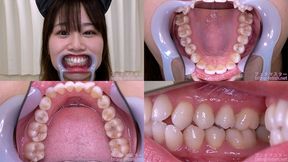 Michi Kitamura - Watching Inside mouth of Japanese cute girl