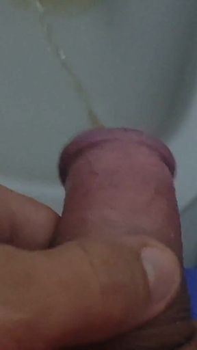 Homemade Method for Freezing the Penis.
