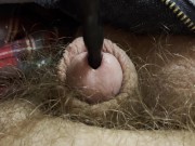 Painful sound removal ends with golden surprise