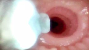 A detailed examination of Lopuza93 oral cavity and anal area using an endoscope camera.