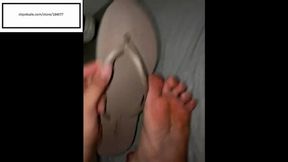 Itchymimis itchy feet from sandals before shower