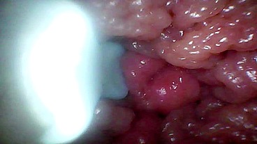 Endoscope camera records my wife's G spot. Educational video