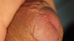 How to Widen a Glans Hole to the Extreme.