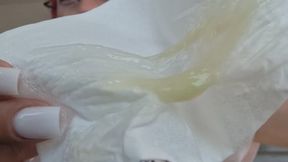 YELLOW SNOT EXPLOSION – Tissue After Tissue Filled with Thick Mucus