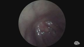 Endoscope Mouth Tour