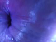 POV - The view staring up my descending colon as I mush you from the outside