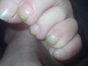 Toenails have gotten long and ugly