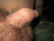 My hairy tiny dick with one testicle