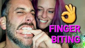 OUCH!!!! Check out the teeth marks!!!!????????