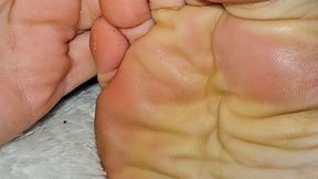 Interesting pattern on my shiny soles