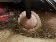 Painful sound removal ends with golden surprise