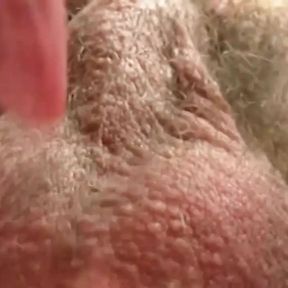 Penetrating feet and hands, of women, in dilated anus that becomes a crater (extreme full anal movie)