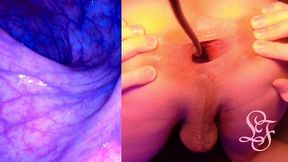 split screen look inside lina s gaping ass with eggs