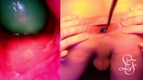 split screen look inside lina s gaping ass with eggs