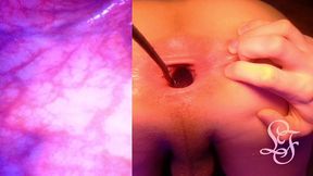 split screen look inside lina s gaping ass with eggs