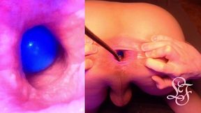 split screen look inside lina s gaping ass with eggs