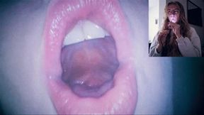 Endoscope in my mouth - burping mp4 FULL HD