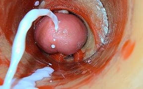 Camera Inside Deep Pussy Captures Overdose Ejaculation of Sperm Asmr