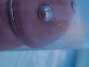 Pool pumping with wand in urethra.