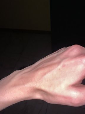 Plumped Veins After the Shower