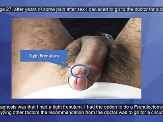 Circumcision? Check this out