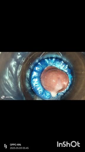 Solo cum compilation