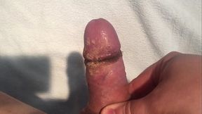 Smegma and grime after two weeks without cleaning