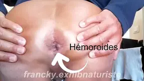 Hard Riding Turns Messy: Raw Stretch Ends in Hemorrhoid Show – GayAmateurs
