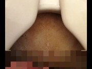Uncircumcised penis pee