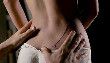 Women with Scars