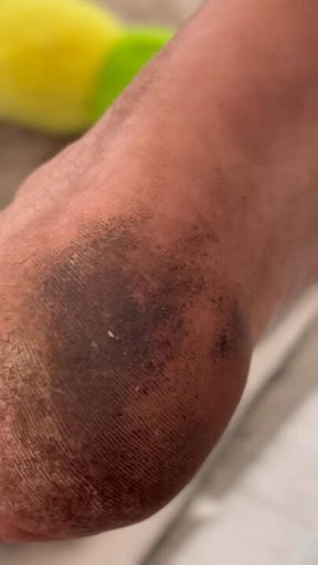 Filthy Soles and Toe Jam