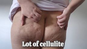My Dimpled Cellulite Ass Jiggles While I Scratch My Bouncy Booty