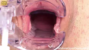 Shy MILF's hidden pleasure exposed by gynecologist