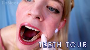 A Tour Of My Teeth