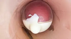 Deep Creampie: Teen Endoscope Captures Huge Sperm Shot