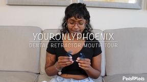 YourOnlyPhoenix Dental Retractor Mouth Tour