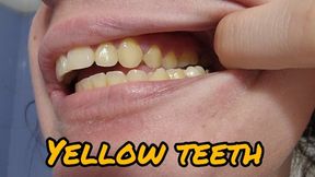 Cleaning My Naturally Yellow Croocked Teeth with Brush & Floss
