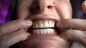 Mouth Tour with Dentures in