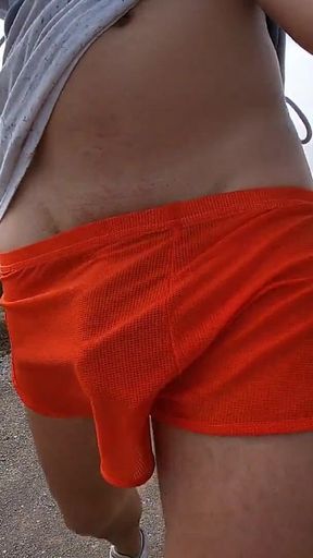 This Is What Happens When I Wear Shorts