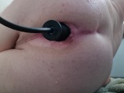 Inflatable butt plug starts my loose ass to prolapse