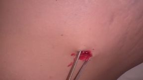 Another bellybutton waxing