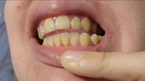 Yellow Dirty Teeth Cleaning – 4 Days Without Brushing – Crooked Teeth, Visible Plaque, Real Close-Up Mouth Fetish