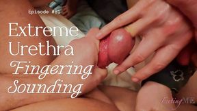 FeetingMe 81 EXTREME URETHRA FINGERING AND SOUNDING