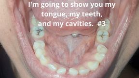 I'm going to show you my tongue, my teeth, and my cavities. #3